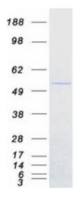 SDS-PAGE (FDXR-1648H).jpg